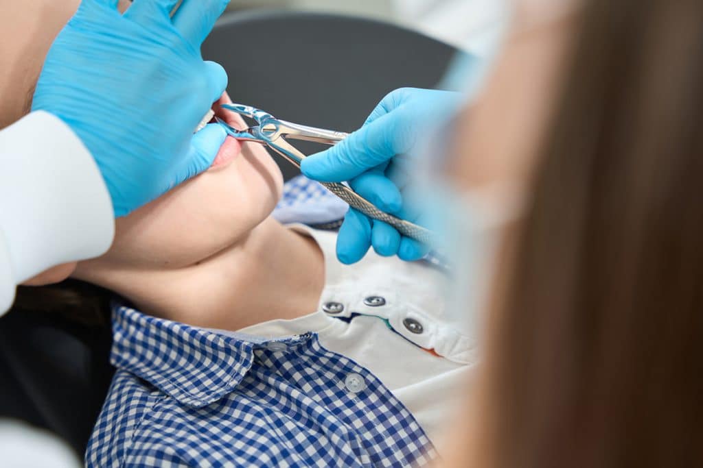Simple vs Surgical Tooth Extractions What Are the Differences?
